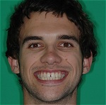 face view before procedures: correct headaches, migranes, sleep apnea, bruxing and tmj problems